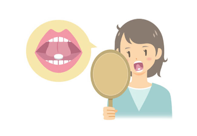舌下免疫療法（スギアレルギー、ダニアレルギー）